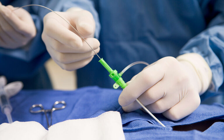 Gefäßchirurgie Passau – Endovaskuläre Therapie Krampfadern EVLT